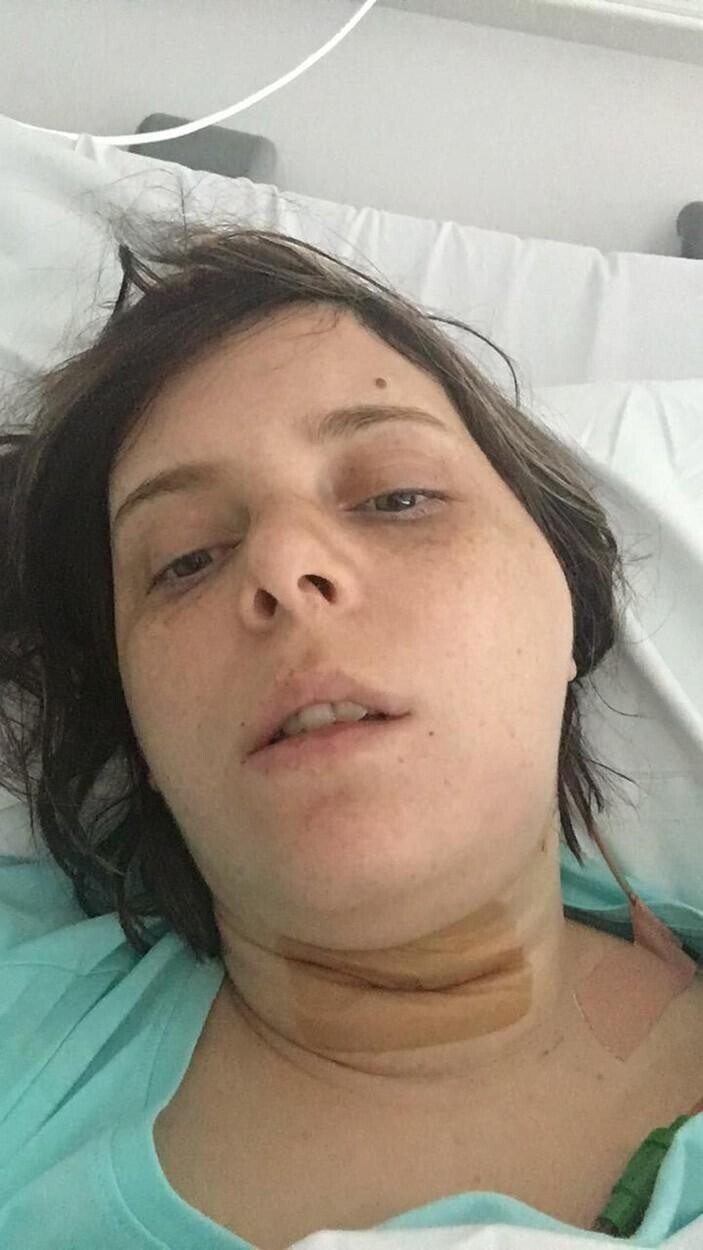 Женщина сломала челюсть бургером