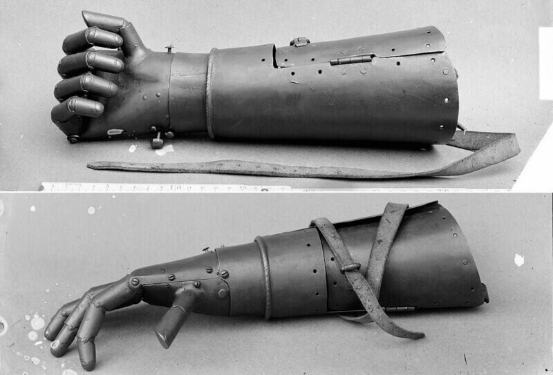Как выглядят протезы, сделанные пятьсот лет назад