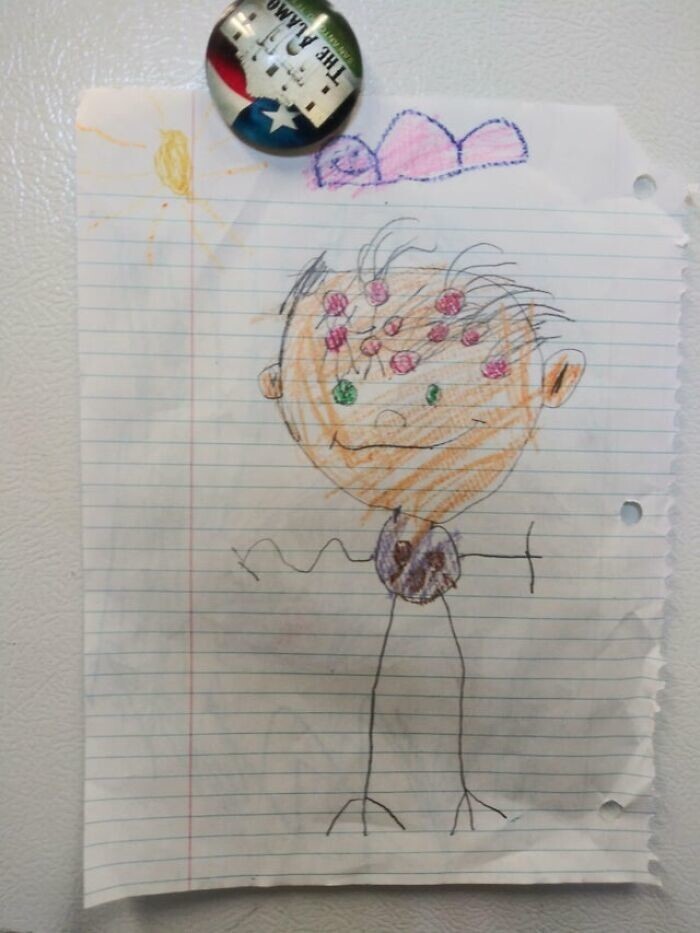 25. "Рисунок моей четырехлетней дочери. Красные кружочки - "дырки, из которых растут волосы".