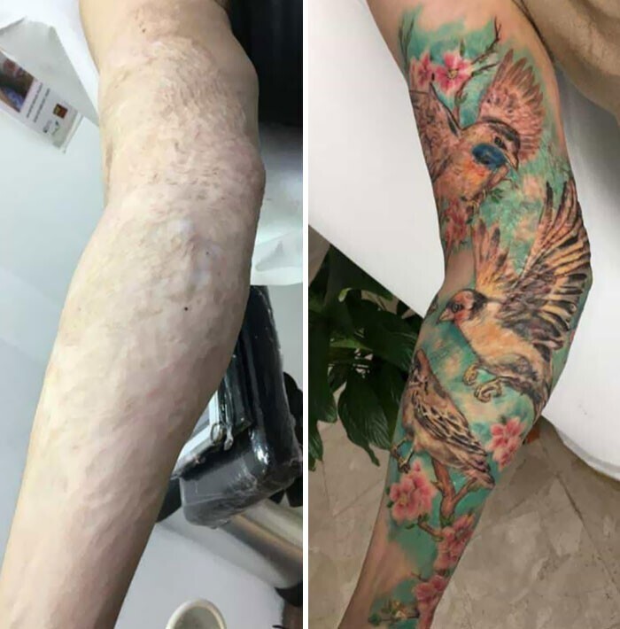 20+ людей, которые попросили тату-мастера перекрыть их шрамы - и получилось круто