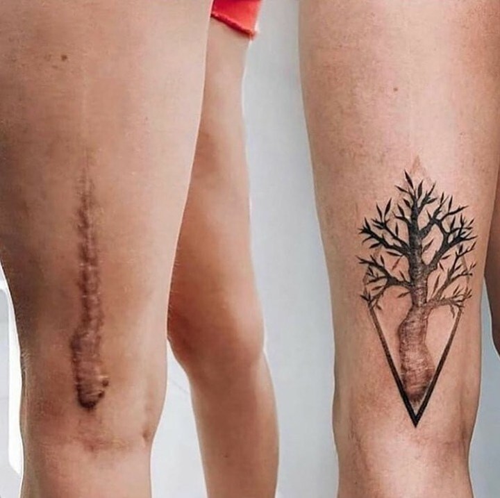 16 татуировок поверх шрамов, с помощью которых люди превратили свои изъяны в изюминку