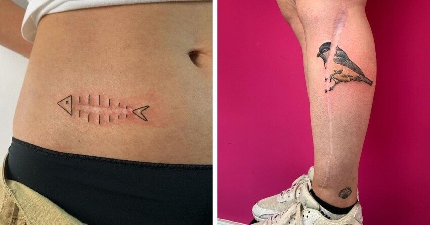 16 татуировок поверх шрамов, с помощью которых люди превратили свои изъяны в изюминку