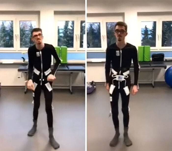 Шведский инженер изобрел специальный костюм с электрической стимуляцией, который избавляет от тремора. Он может спасти людей с болезнью Паркинсона и другими недугами