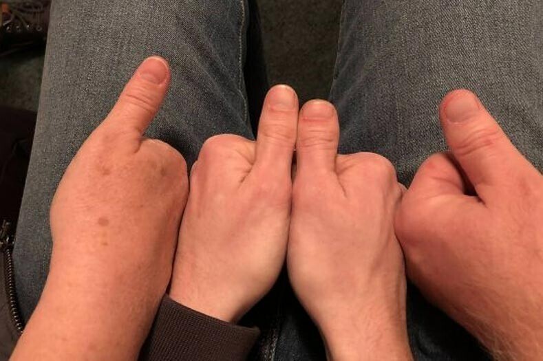 Человек, у которого на двух руках - совершенно разные большие пальцы