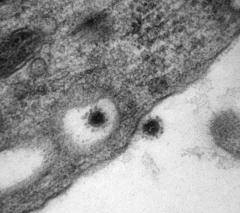 Центр «Вектор» впервые опубликовали снимок смертельного вируса