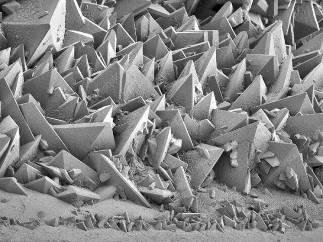 Камни, извлеченные из почек, под микроскопом