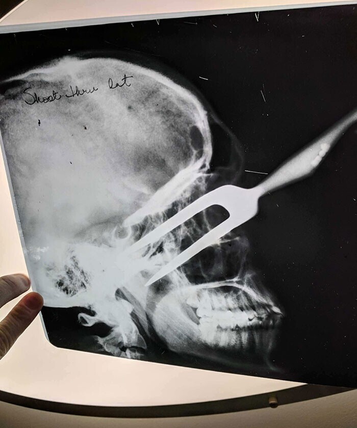 27. "Мой приятель купил дом, нашел несколько рентгеновских снимков в старой коробке"