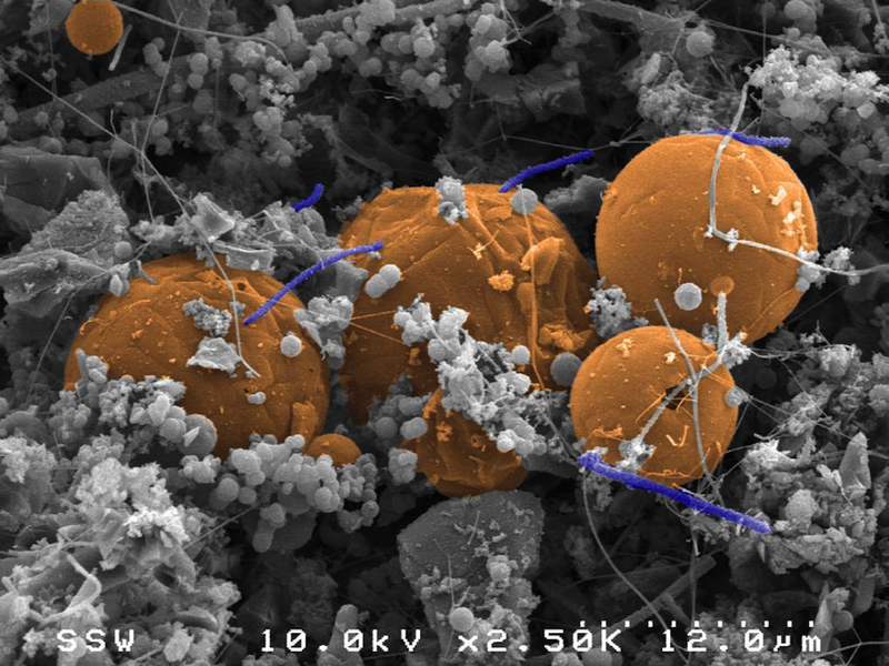 Бактерии Candidatus Desulforudis audaxviator получают энергию, используя водород, получающийся при распаде молекул воды под действием радиации