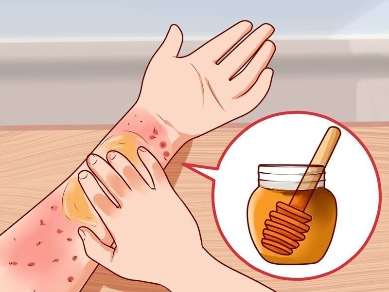 Как нанести мед на рану