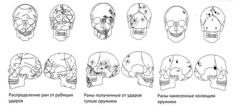 Как и от чего гибли воины в Средние века (длиннопост)