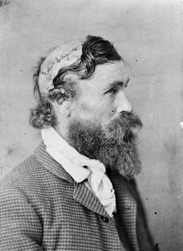 18. Роберт МакГи, человек, с которого индейцы в детстве сняли скальп, 1864 год