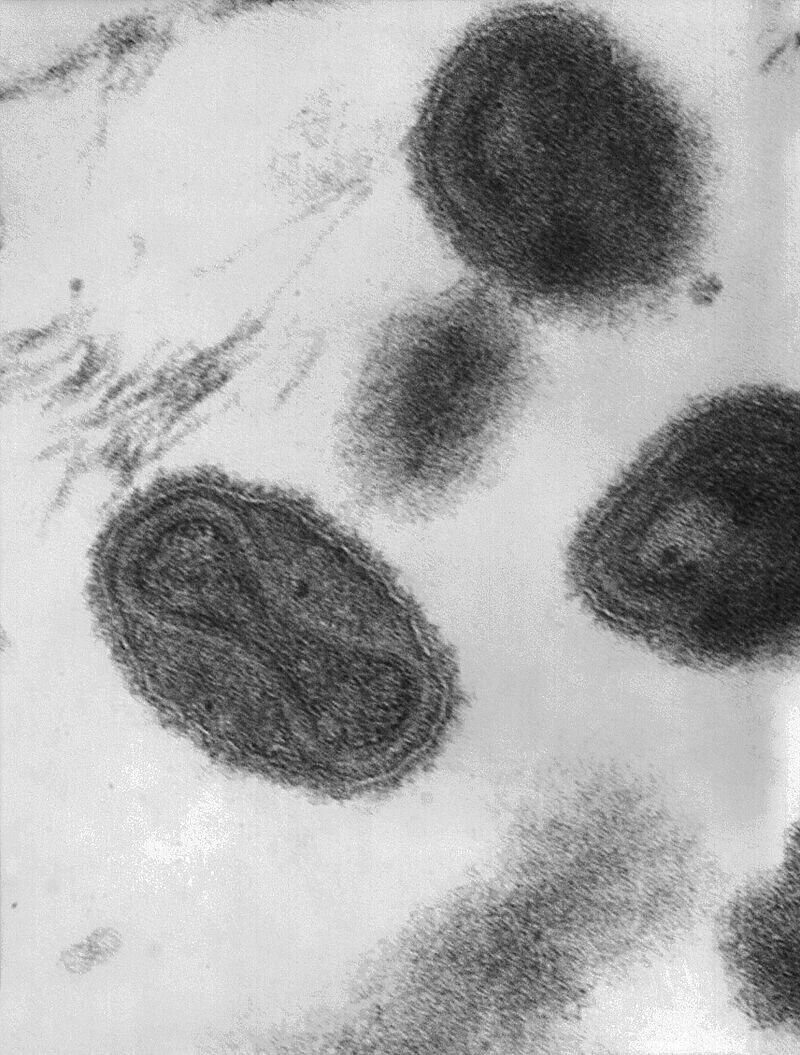 Вирус натуральной оспы (Variola virus)