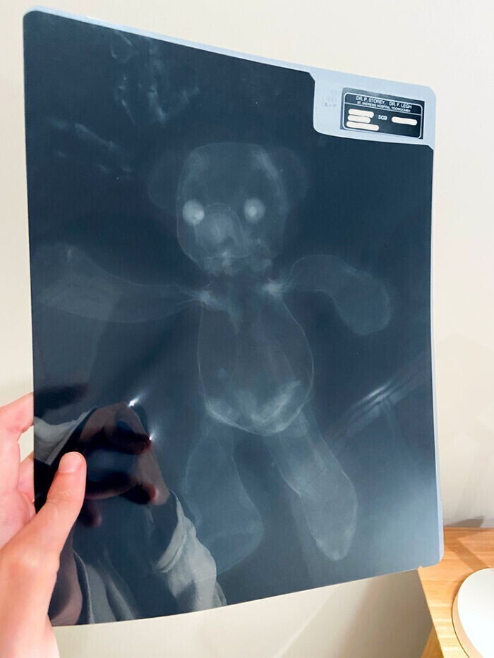 Рентгеновский снимок плюшевого медведя из моего детства, сделанный в 90-х годах