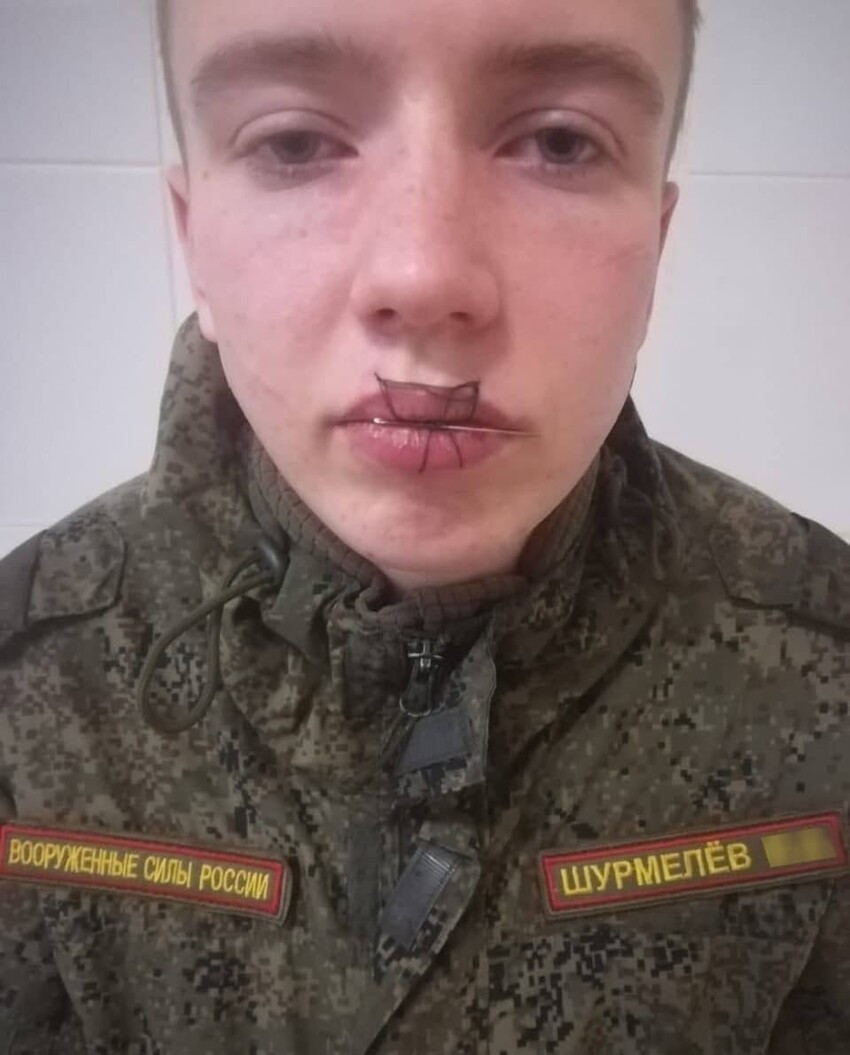 В челябинской воинской части срочник зашил себе рот