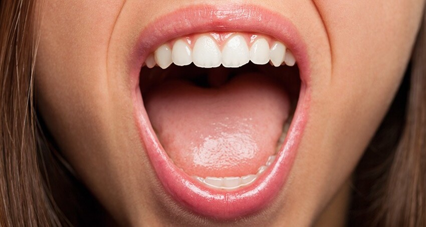 19. «Наверное, рот, учитывая, как часто люди вырастают с плохими зубами, если в детстве им не ставили брекеты»