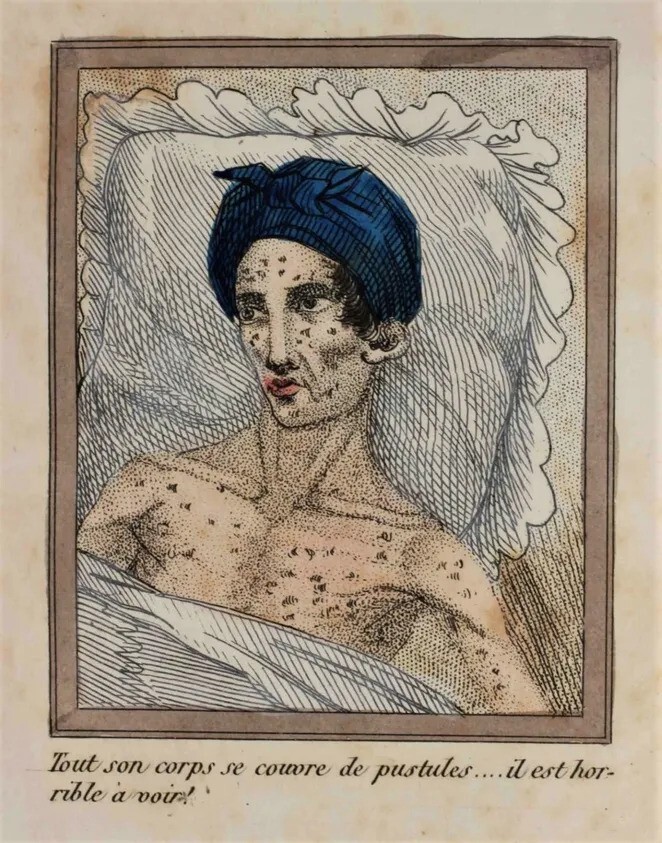 Медики XIX века - об ужасах мастурбации