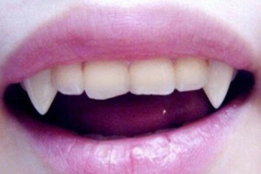 32 способа, чтобы выделиться: как люди пришли к украшению своих зубов