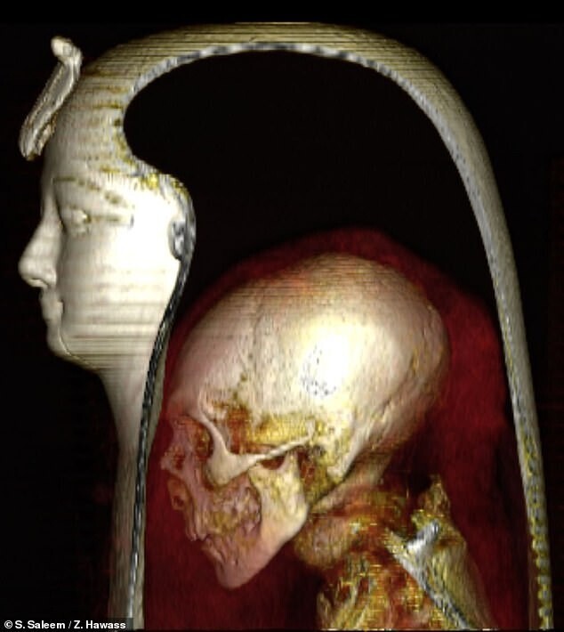 Аменхотепу I впервые сделали компьютерную томографию