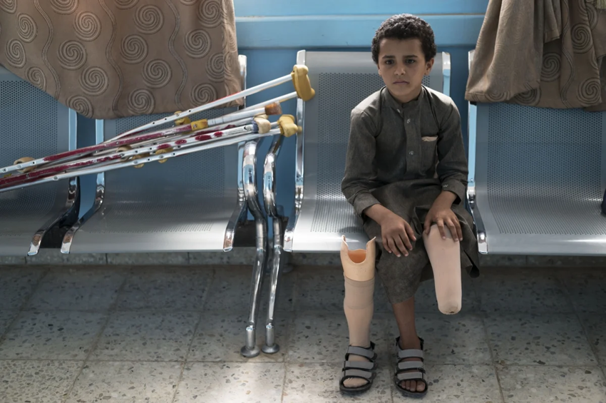 9-летний Салех аль-Вабель потерял левую ногу, попав на противопехотную мину недалеко от своего дома в Марибе, Йемен.  