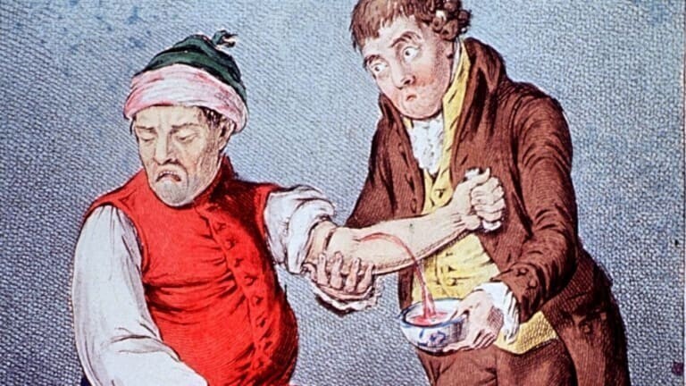 13. В 18 веке врачи считали, что регулярное кровопускание - залог здоровья