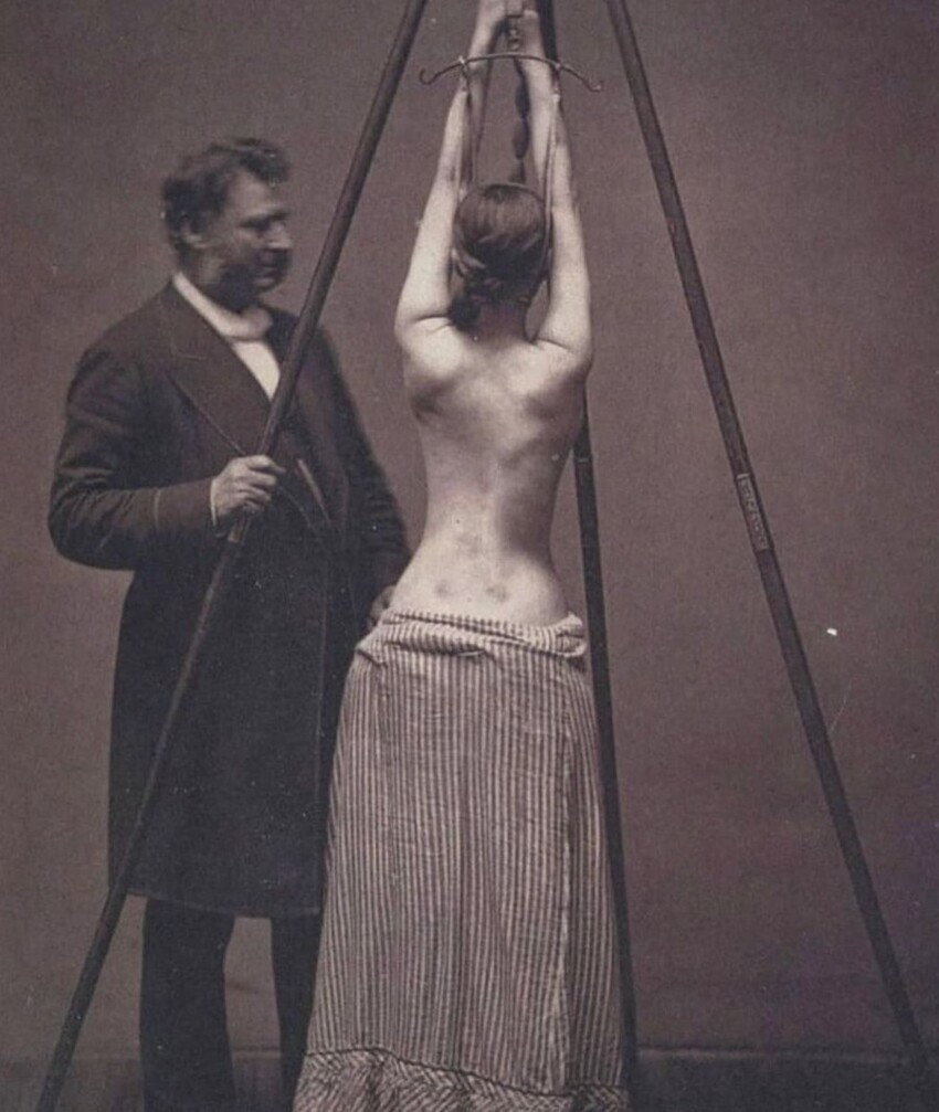 19. Доктор Льюис Сейр лечит больную сколиозом (1870-е годы)