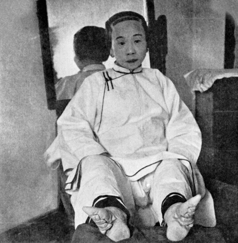 Такие ноги в Китае традиционно назывались «золотыми лотосами», а от величины деформированной стопы напрямую зависел престиж невесты. Благо эта древняя китайская традиция бинтования женских ног канула в Лету.