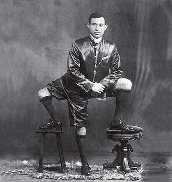 23. Фрэнк Лентини, обладатель 3 ног, 4 ступней, 16 пальцев на ногах и 2 функционирующих половых органов (1884-1966)