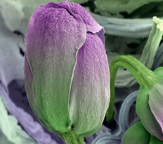 Этот удивительный макромир: невероятные фотографии обычной еды под микроскопом