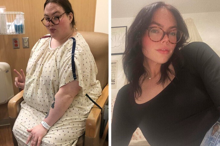 14. "До и после похудения на 140 кг"