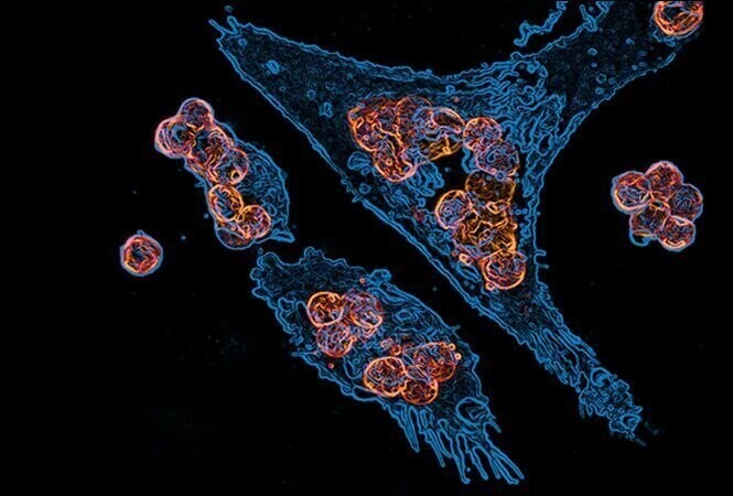Захват макрофагами клеток опухоли