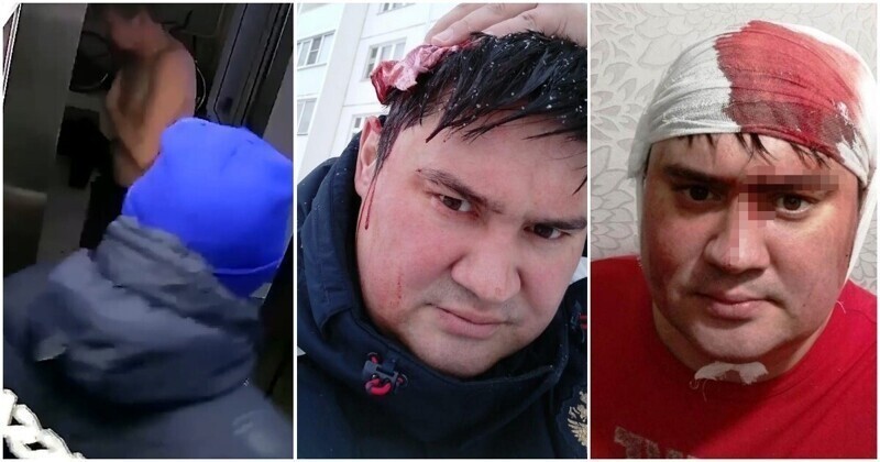 В Новосибирске мужчине в голову неожиданно прилетел топор