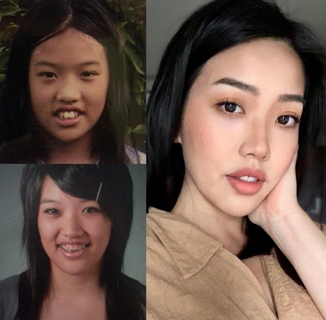 Девушке на фото 10, затем 18 и 29 лет