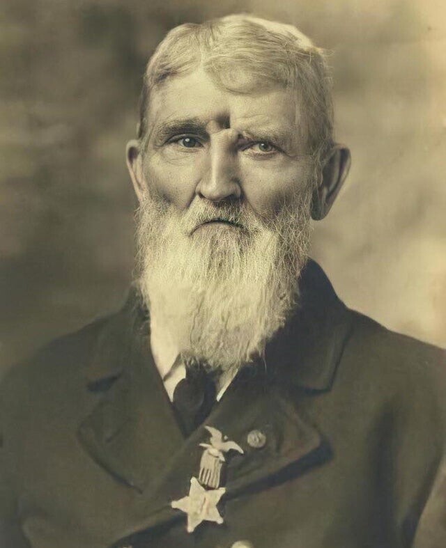 Американский солдат Гражданской войны, который пережил выстрел между глаз 1863