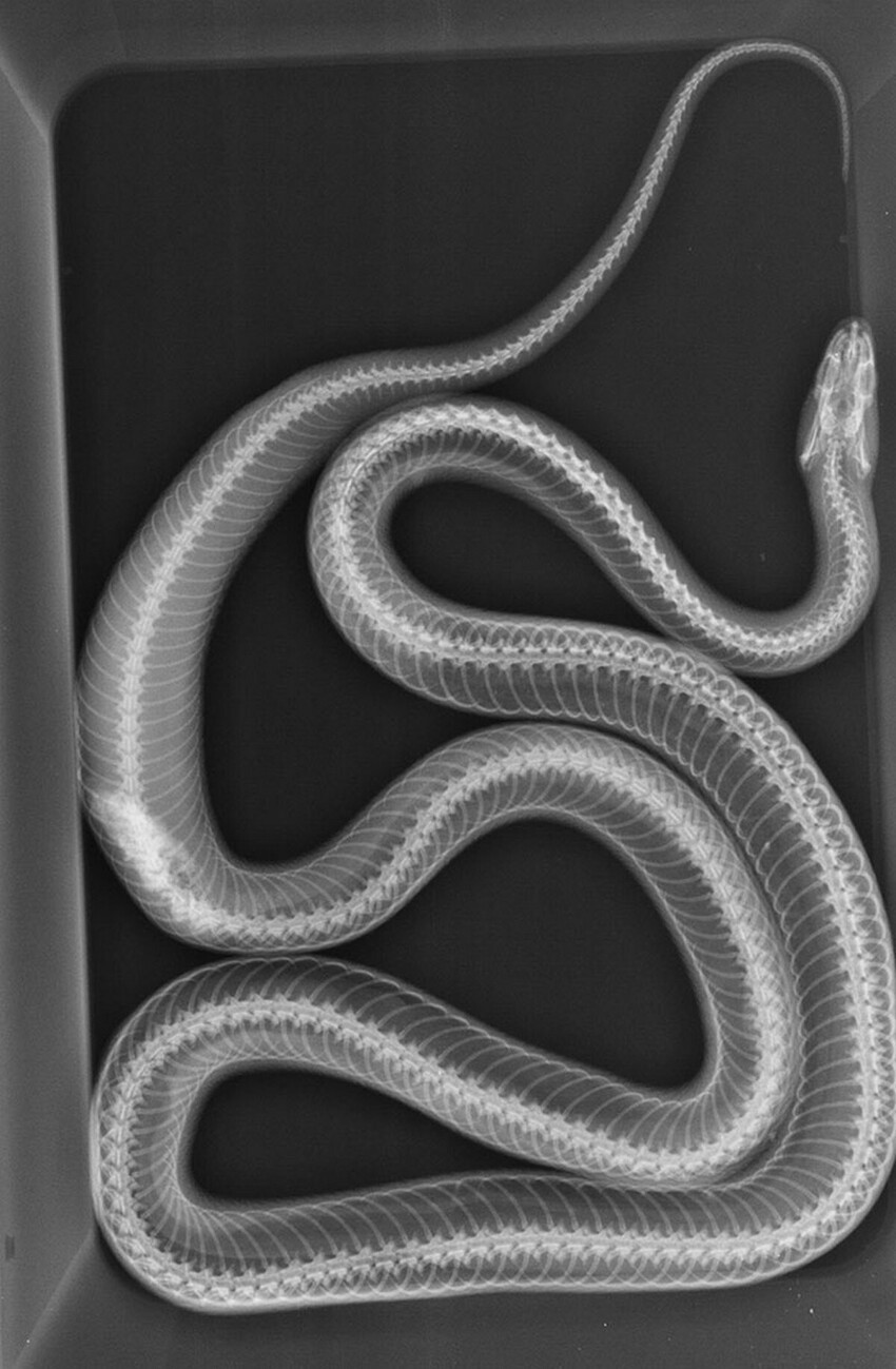 У этой змеи - опухоль почки. Она отчетливо видна на рентгене. Снимком поделился ветеринар, который будет делать змее операцию
