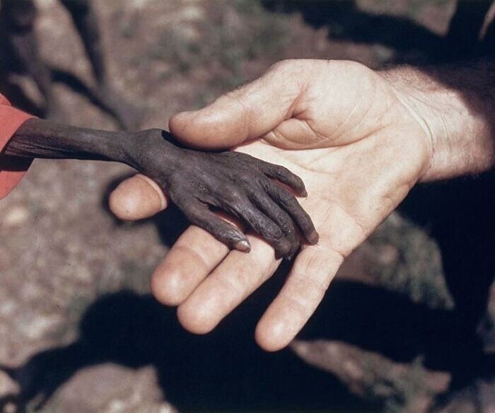 11. Рука истощенного голодом мальчика и католического миссионера. Уганда, 1980 год. Фото Майкла Уэллса
