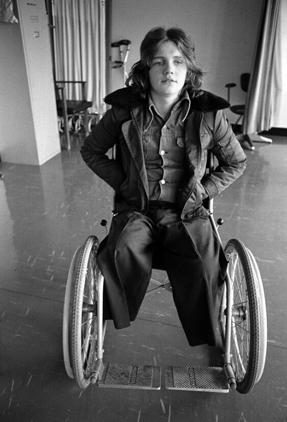 10 марта 1972 года. Этот подросток потерял ноги в результате взрыва бомбы в пабе в Белфасте. Фото Alex Bowie.