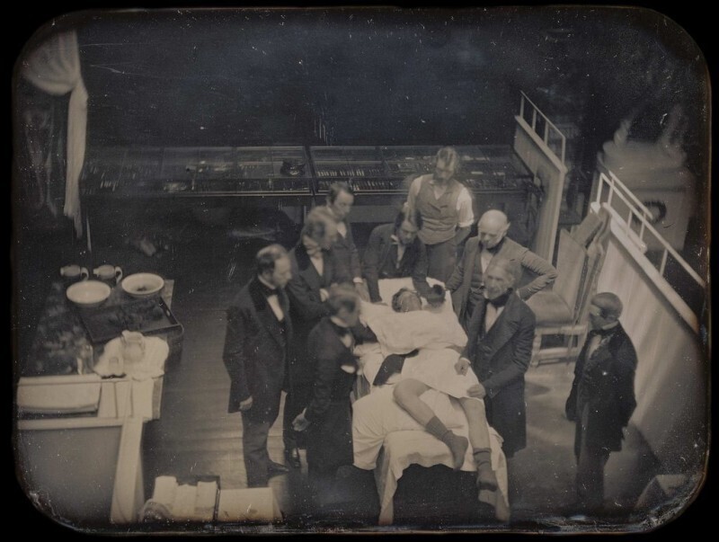 Первая известная фотография проведения медицинской операции, 1847 год