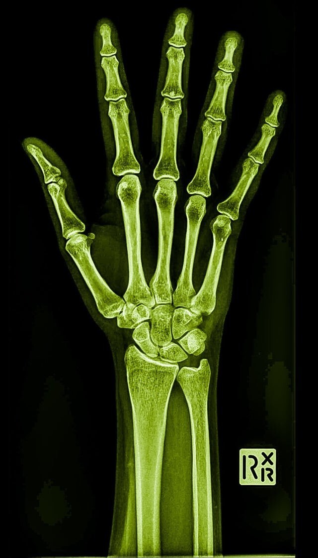 16 любопытных рентгеновских снимков