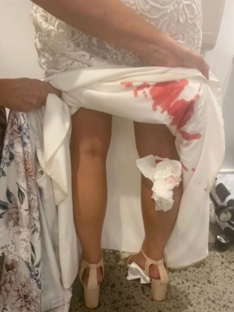 В Австралии жених испытал шок, увидев, что пряталось под платьем невесты