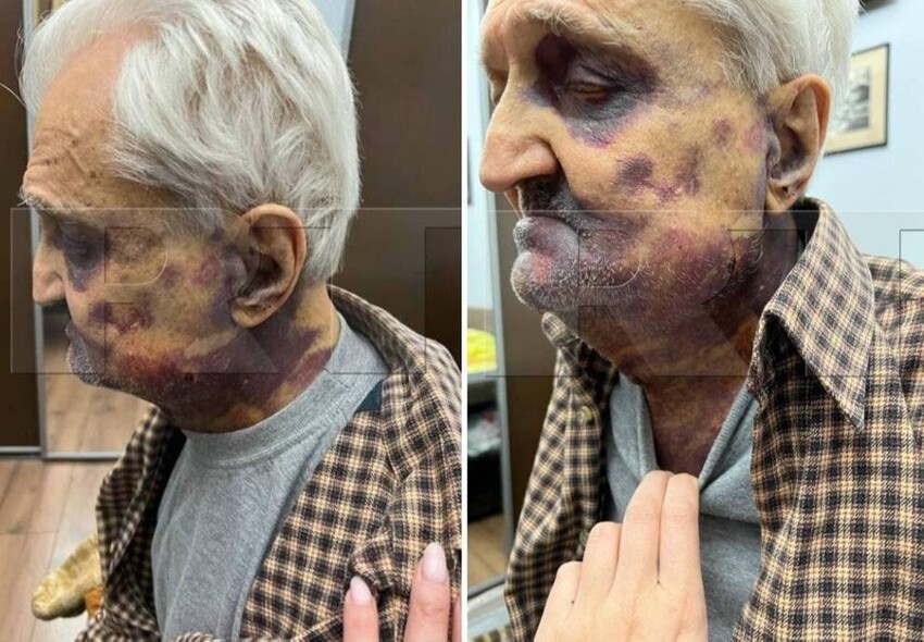 Уроженец Киева избил пенсионера-москвича, поддерживающего спецоперацию