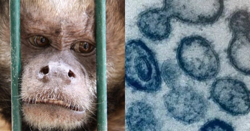 Понеслось: в России выявили первый случай оспы обезьян