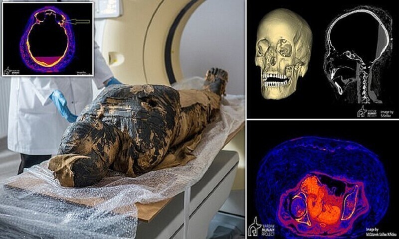 Ученые обнаружили рак у беременной египетской мумии
