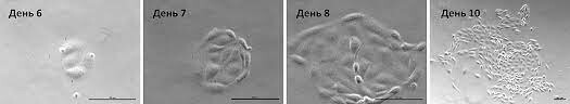 Ученые,используя стволовые клетки,создали первый"синтетический"эмбрион