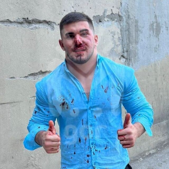 "Чеченскому Халку" в Дагестане разбили лицо из-за неправильной парковки