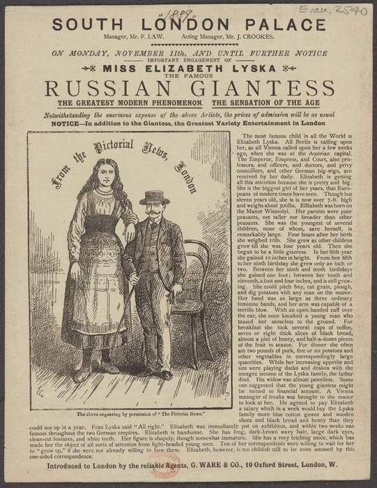 «Огромная Лиза»: какого роста была самая высокая женщина Российской империи