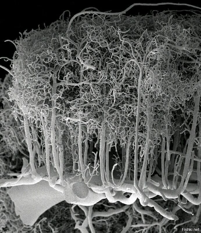 Сосуды коры головного мозга человека 