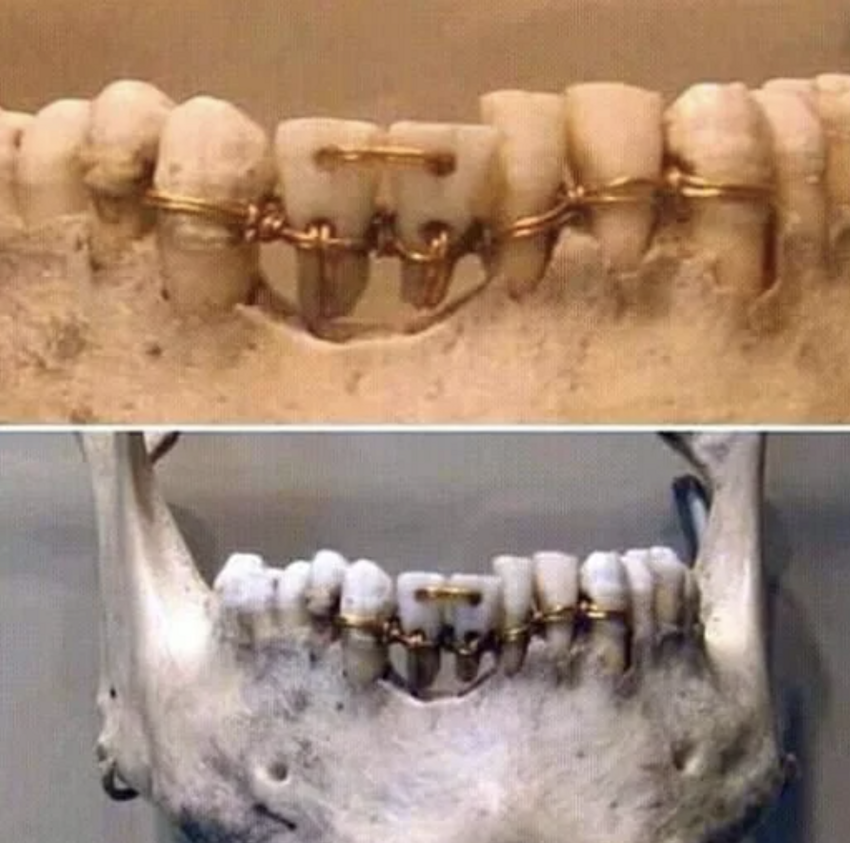 Стоматологическая работа, которой 1400 лет