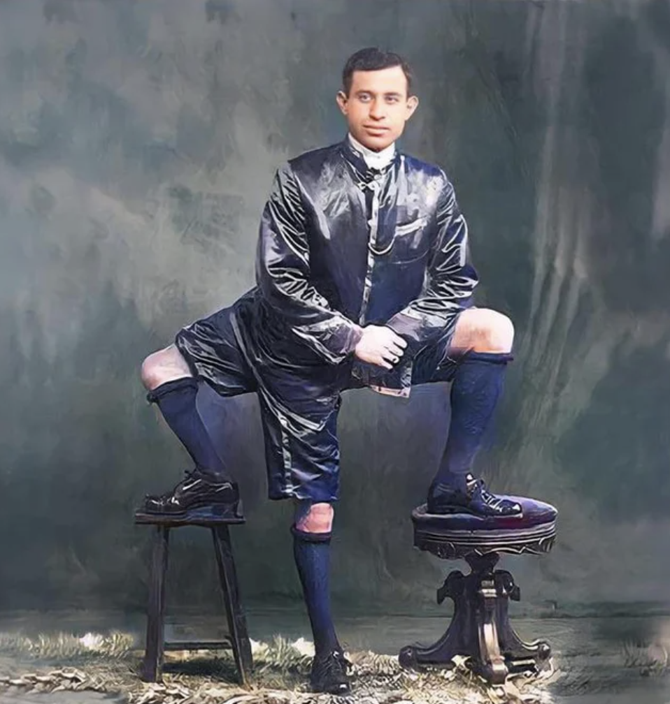 Франческо Лентини - человек, родившийся с близнецом-паразитом, из-за чего у него было три ноги. В 1900-е годы давал выступления в цирках, благодаря чему получил известность