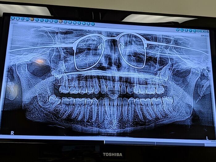 15. "Сделал на днях панорамный снимок зубов. Стоматолог забыл сказать мне снять очки"