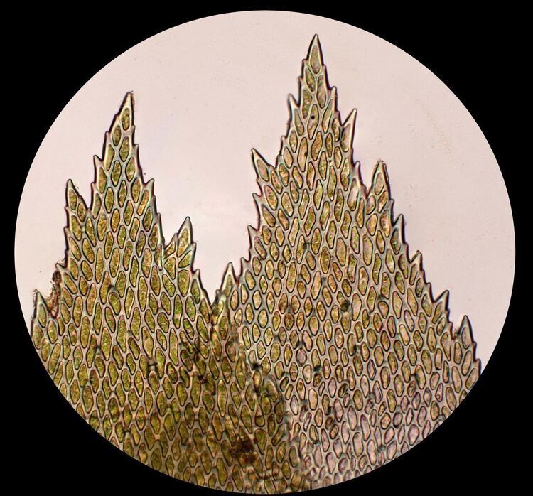 Увеличенные кончики листьев мха, окрашенные разбавленным раствором йода